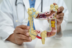 Fodmap